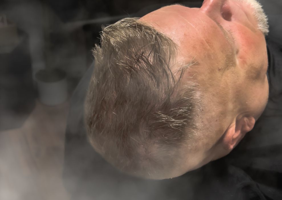 Premium Scalp Therapy- Custom (2/2)