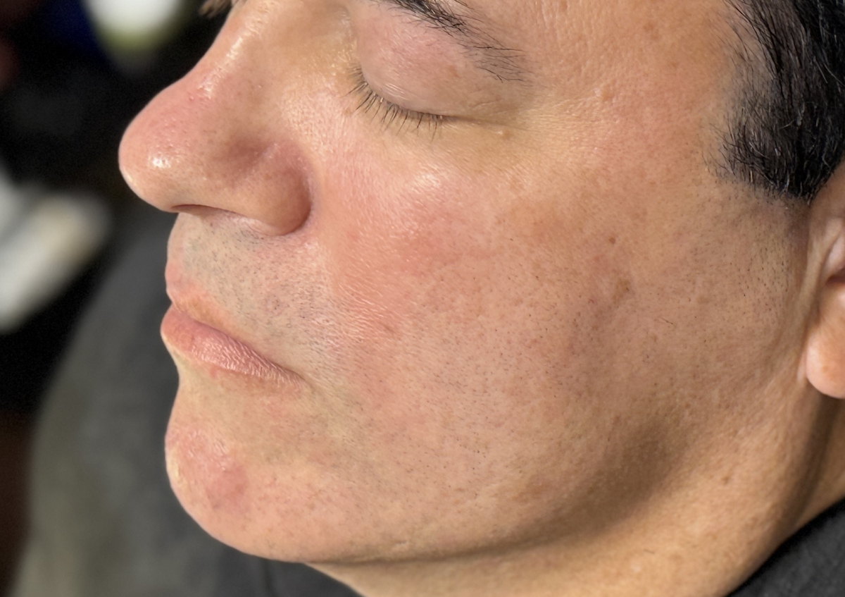 Precision Full Face Shave