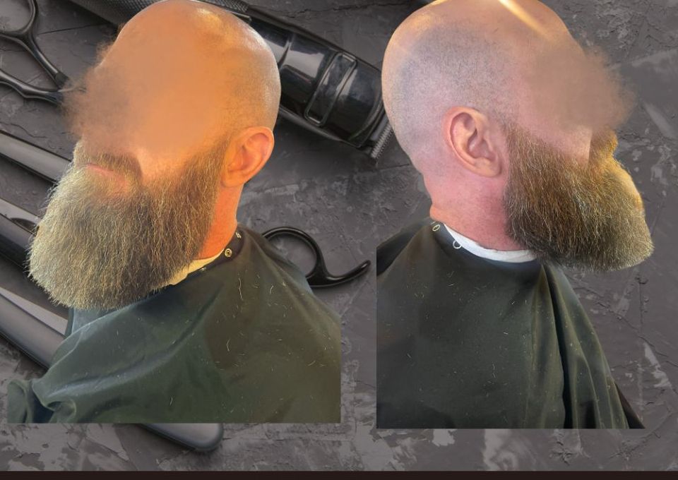 Deluxe Beard Trim