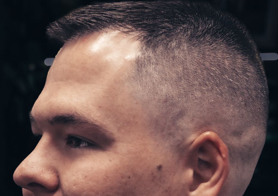 Precision Skin Fade (2/2)