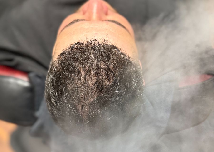 Premium Scalp Therapy- Custom (1/2)