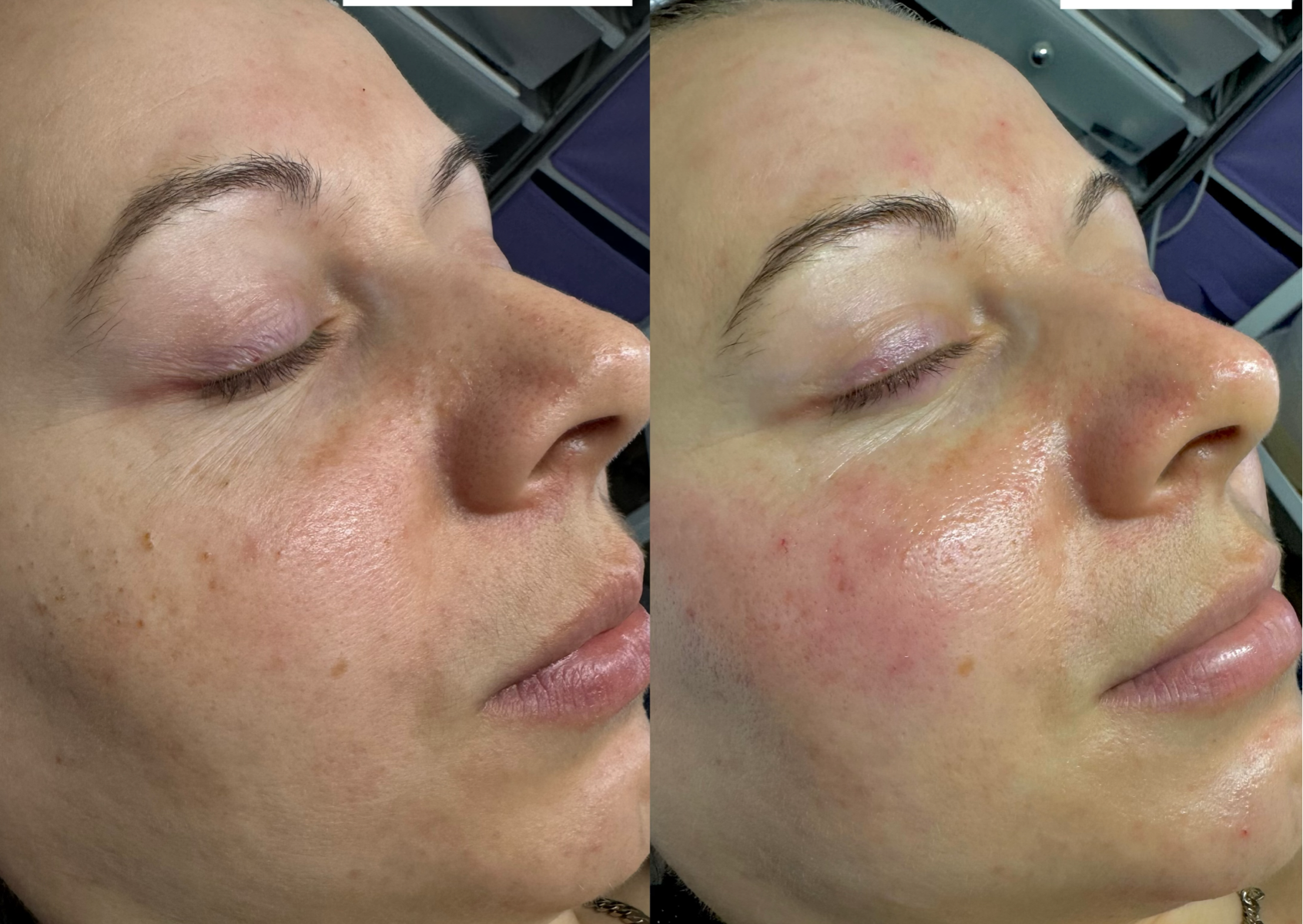 Deep Cleansing & Intensive Hydration