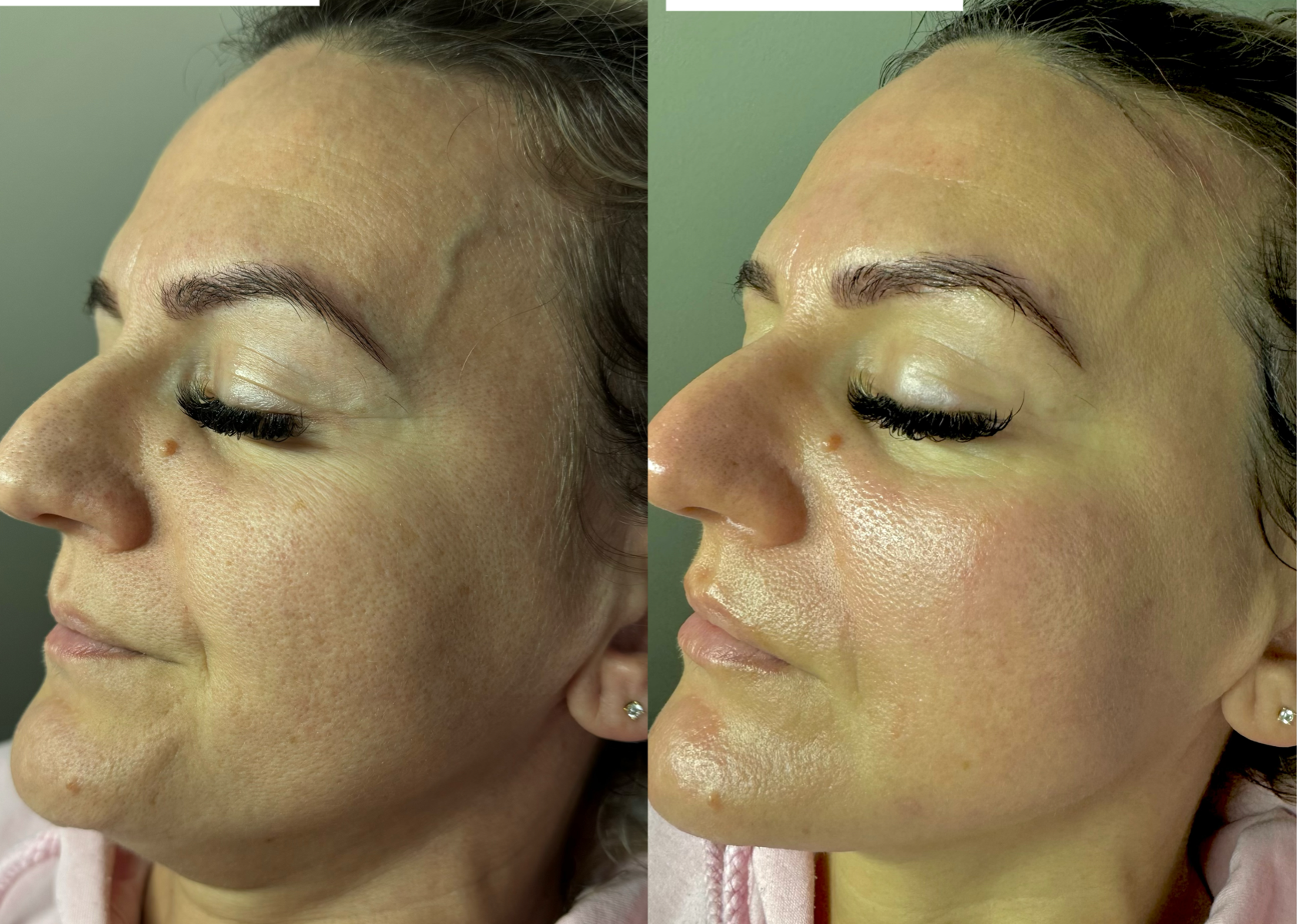 Deep Cleansing & Rejuvenation Facial