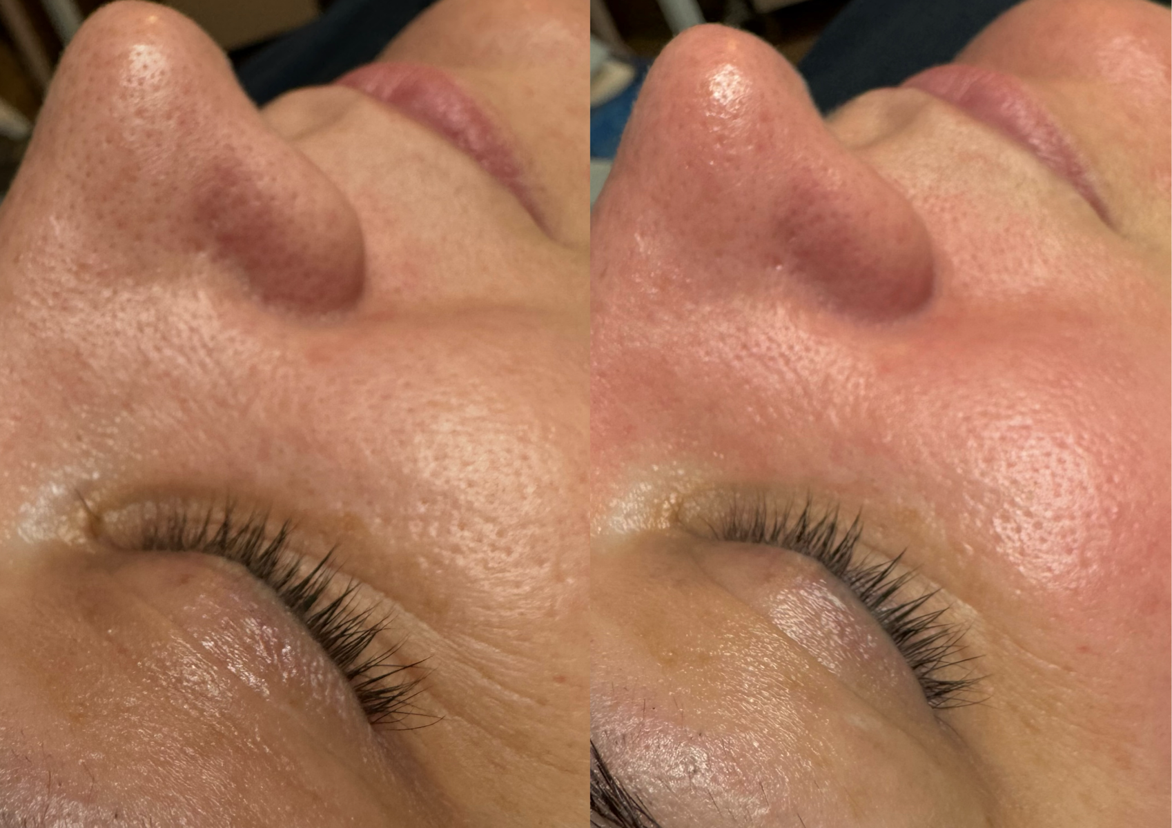 Ultimate Deep Cleansing Facial