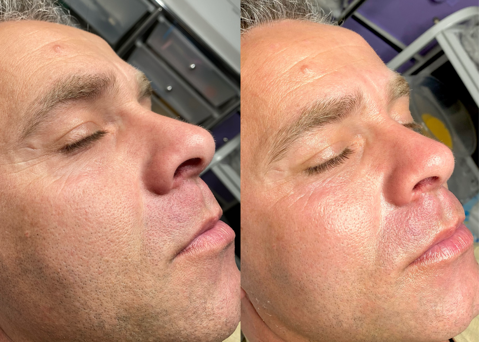 Gentleman’s facial