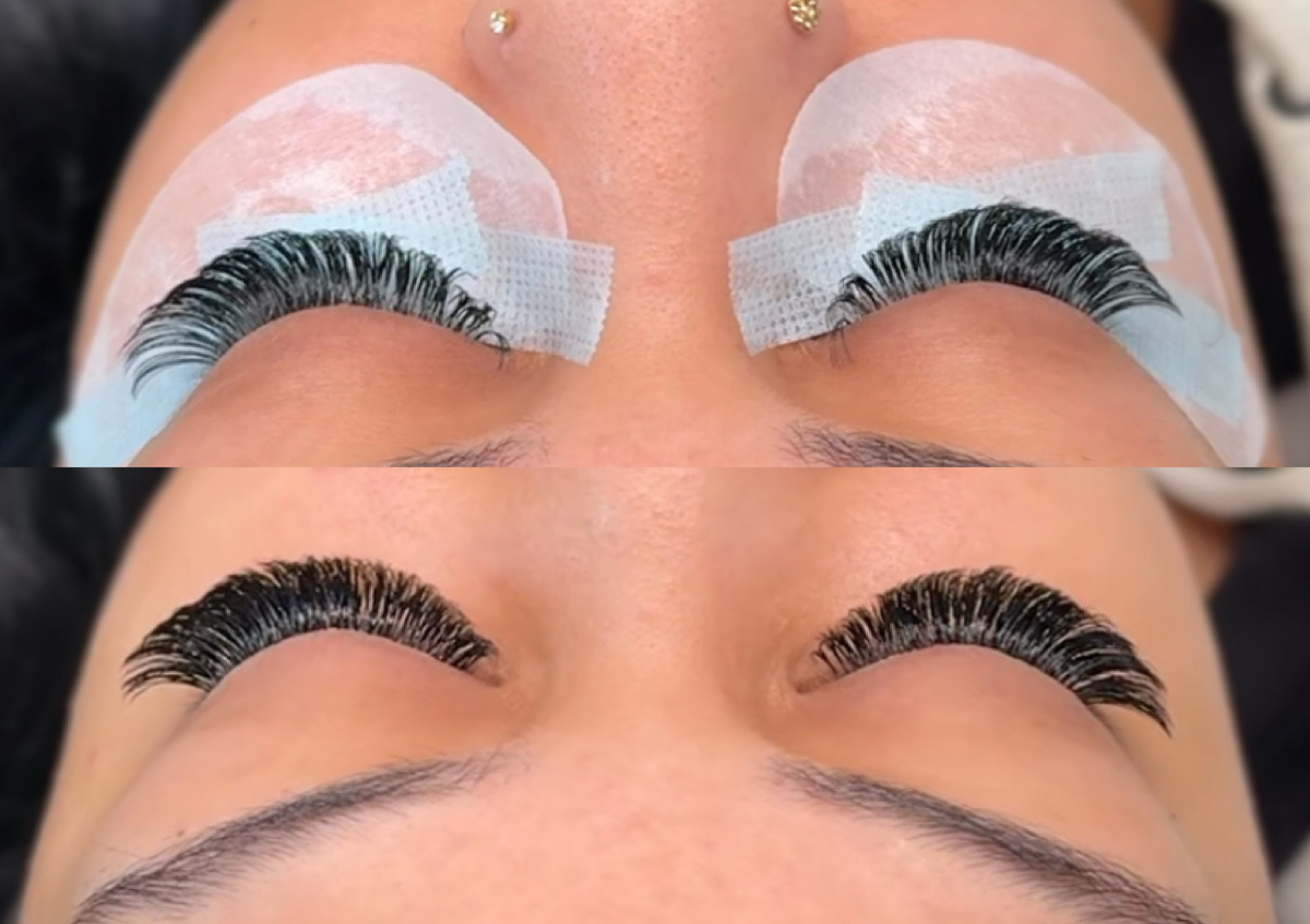 Refill  2-3 wk