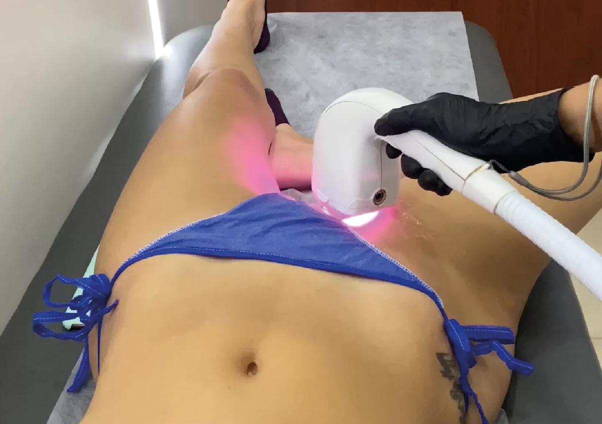 Láser diodo bikini (×5)