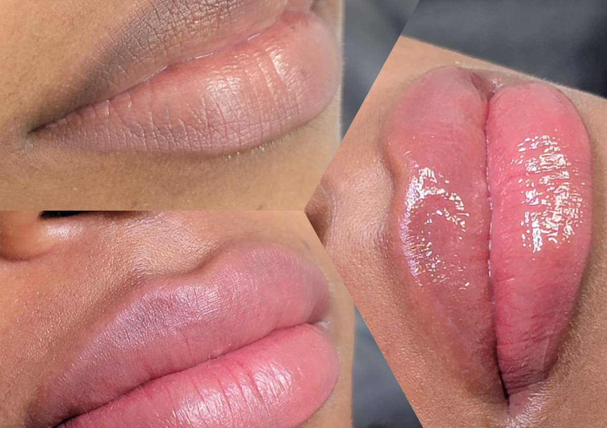 Neutra lips