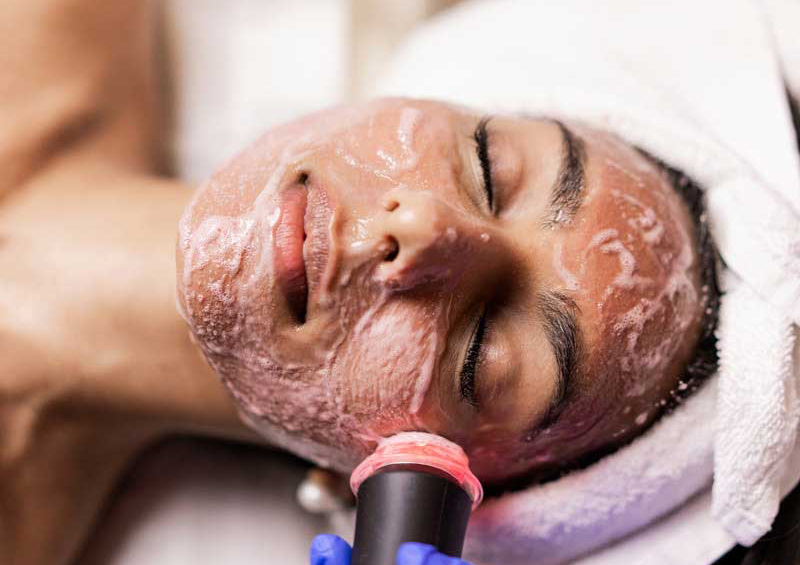 Oxigeneo facial