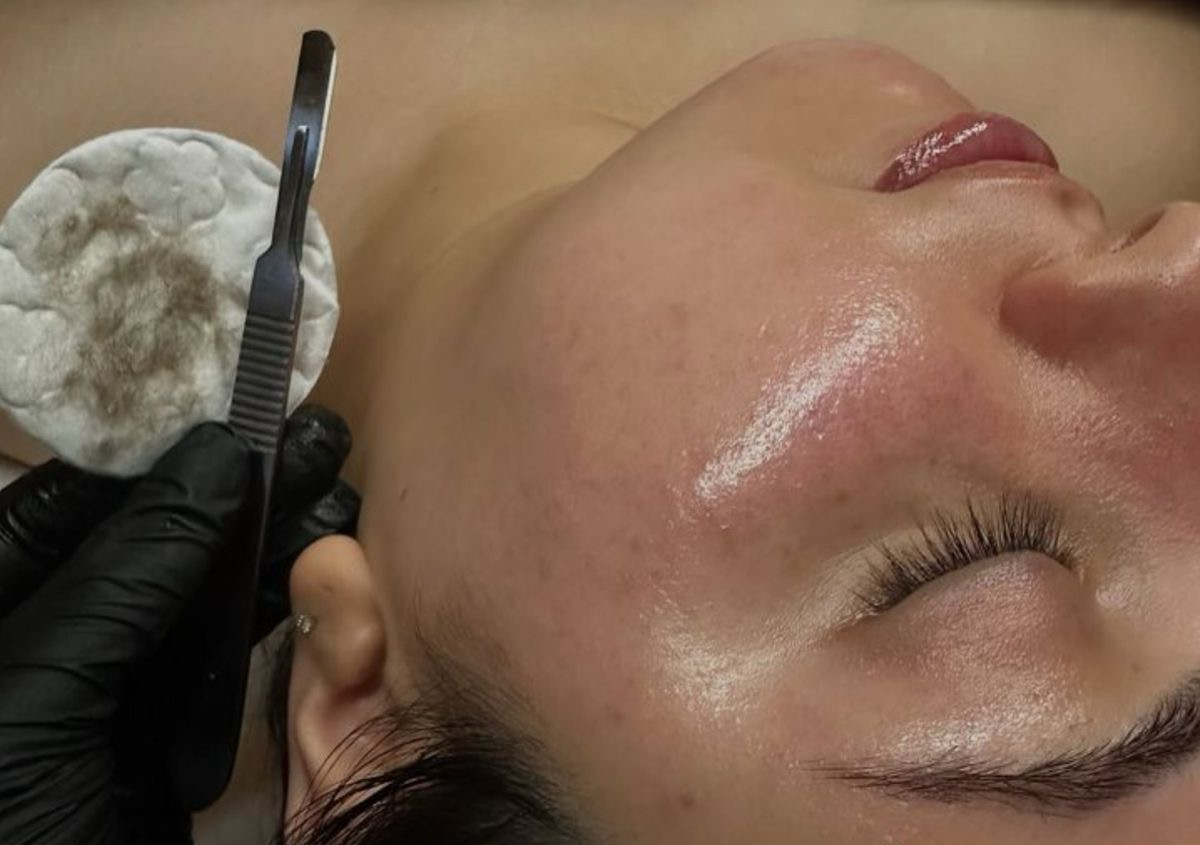 facial profundo + dermaplane 