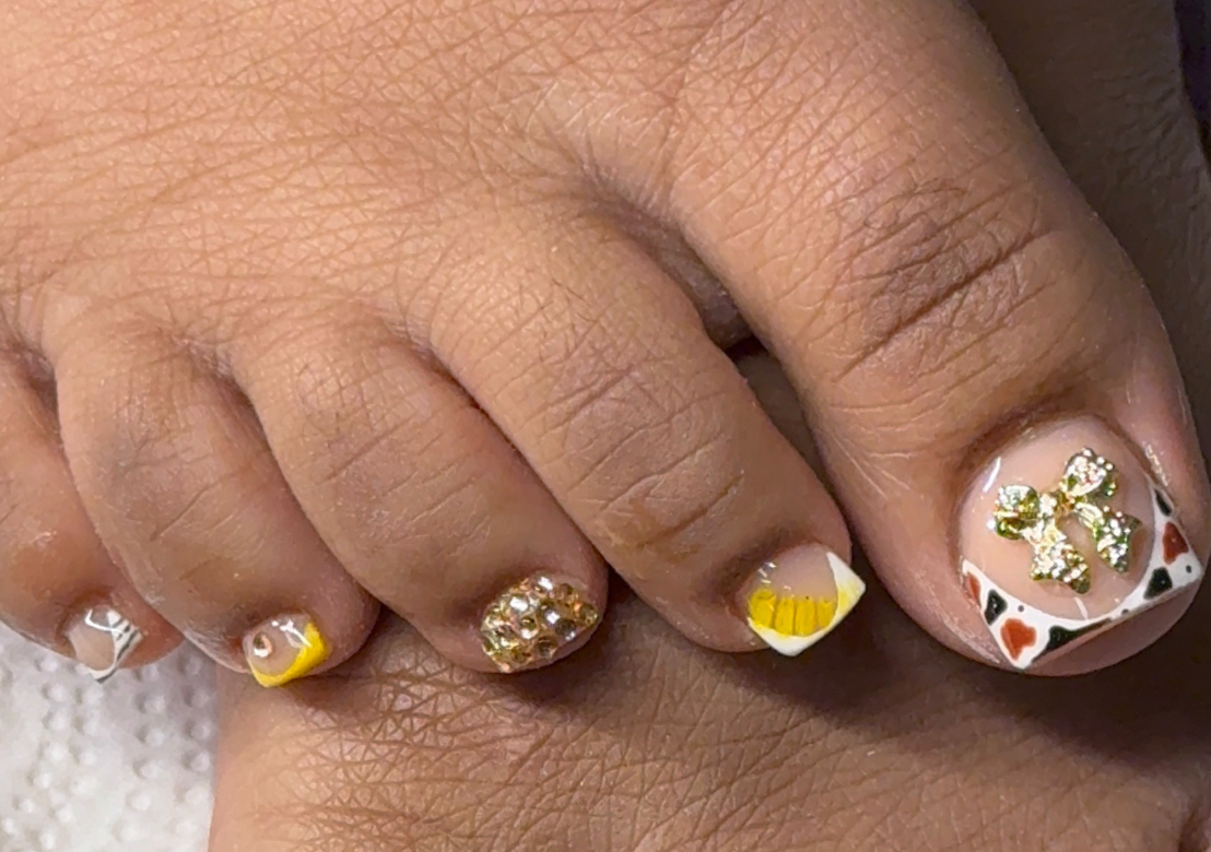 Acrylic Toes 