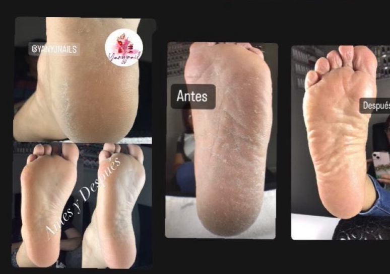 Pedicura con Podología ,Esmalte en Gel +Parafina