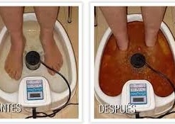 Desintoxicacion ionica