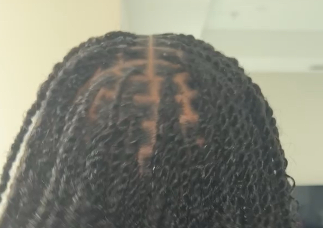 Xtra Small  Mini Twist