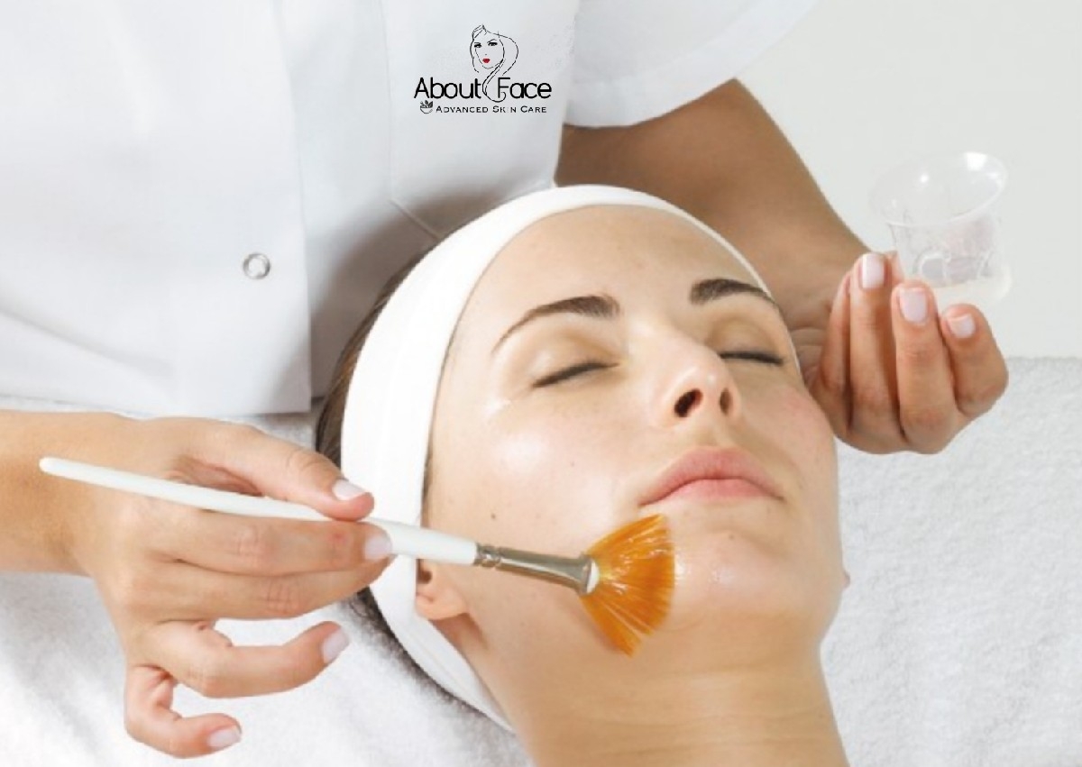 Vitamin A Peptide Peel