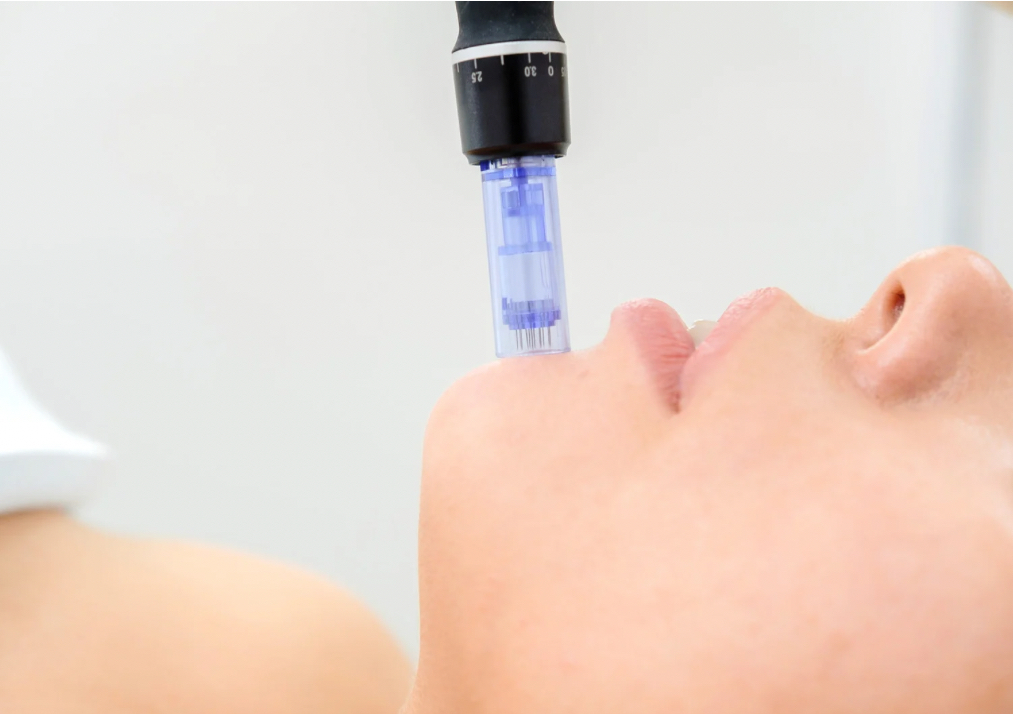 Microagujas Skinpen/DP4