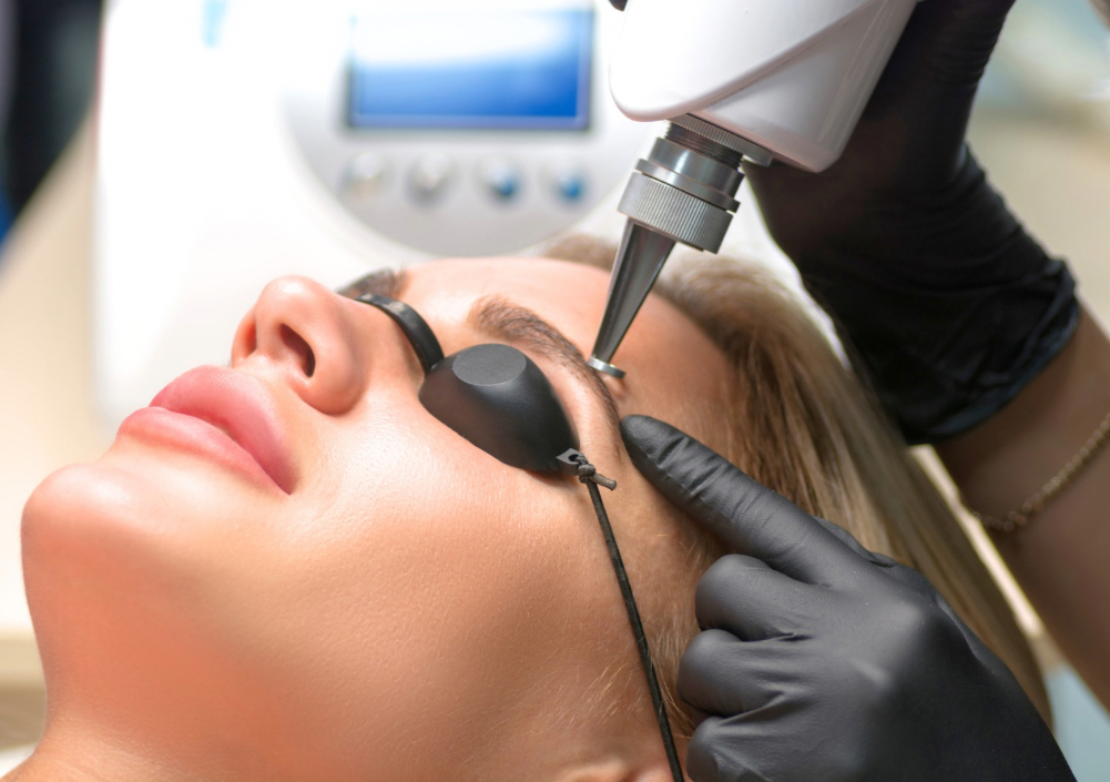 Picolaser Remoción Tatuaje Cejas