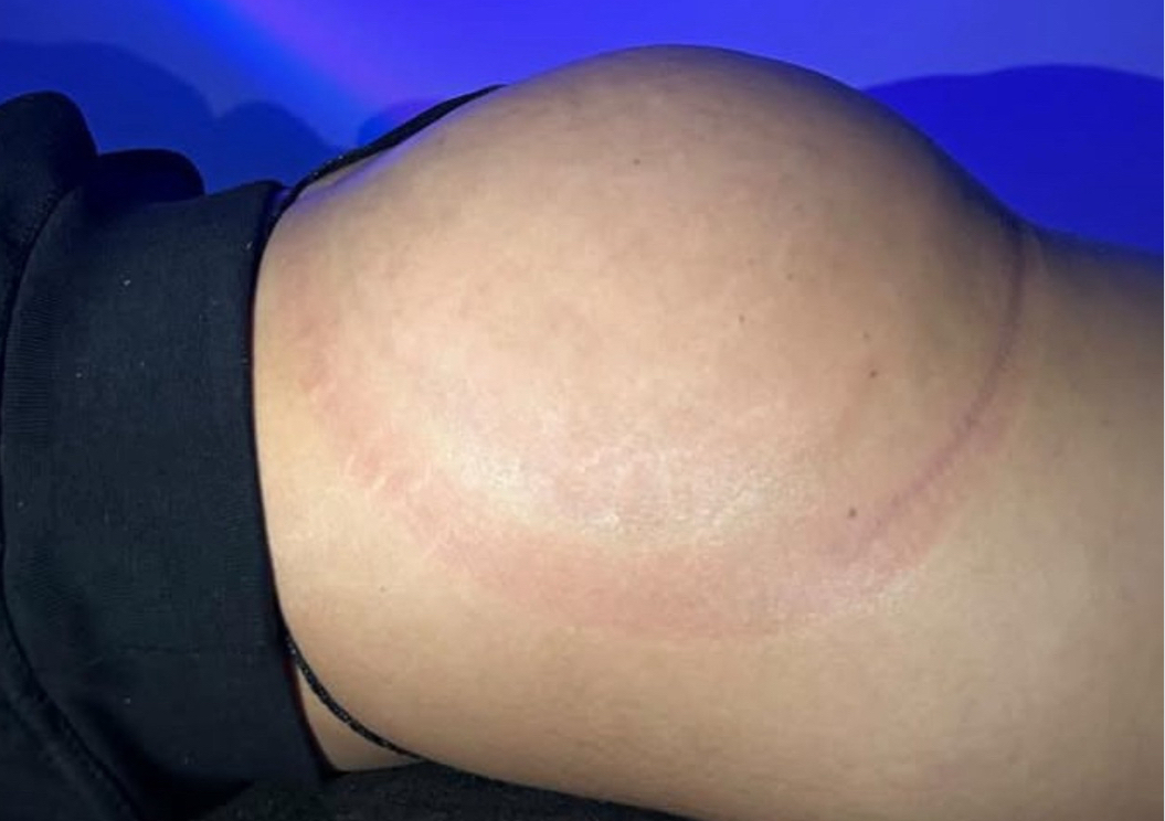 ((12)sesiones Gluteos perfectos
