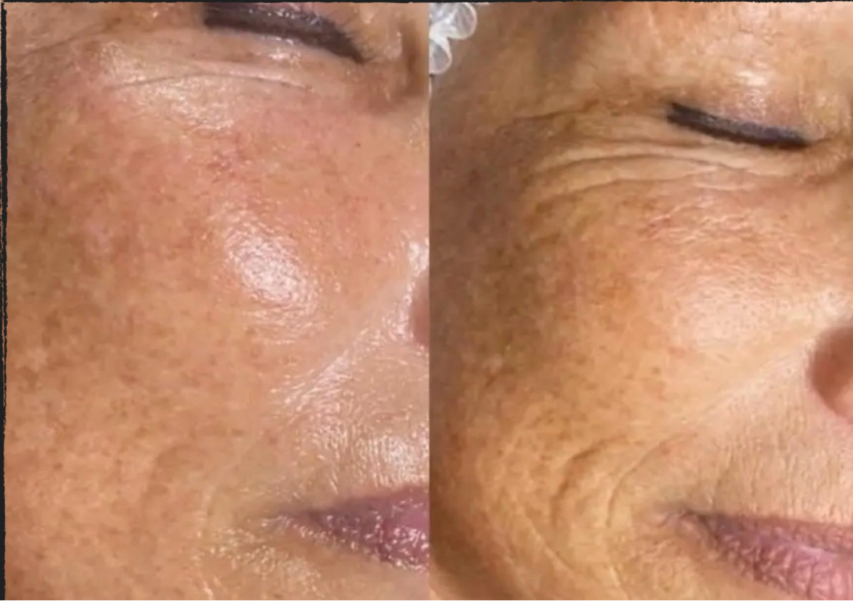 Skin Rebirth Experience