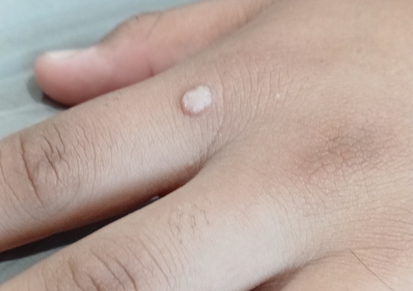 Eliminacion de mezquinos