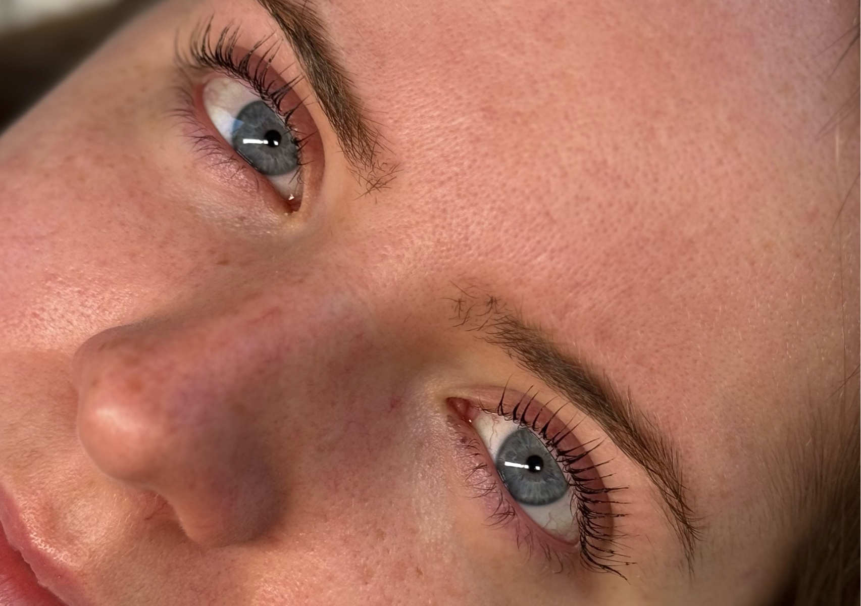Patch Test 