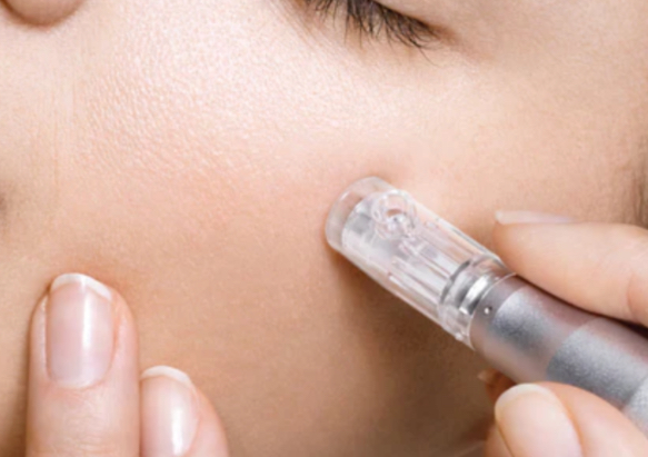 ᴍɪᴄʀᴏɴᴇᴇᴅʟɪɴɢ