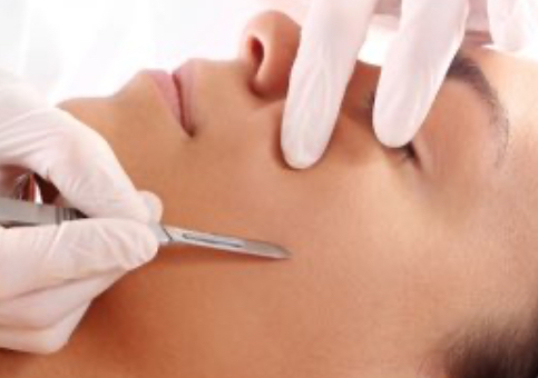 ᴅᴇʀᴍᴀᴘʟᴀɴɪɴɢ 