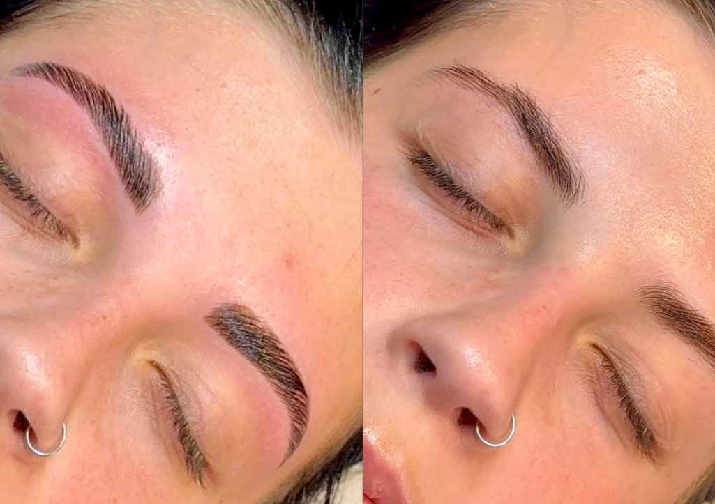 ᴇʏᴇʙʀᴏᴡ ʟᴀᴍɪɴᴀᴛɪᴏɴ 