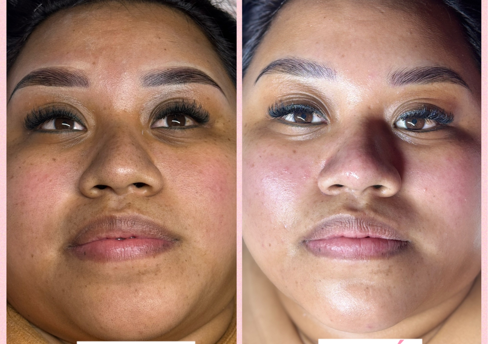 Delux facial (deep cleaning incluids dermaplaning)