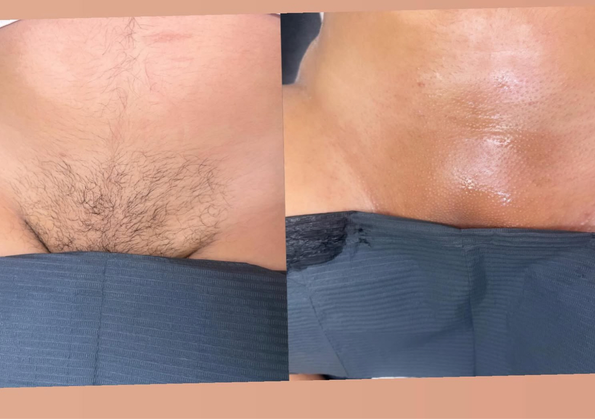 Vajacial & wax