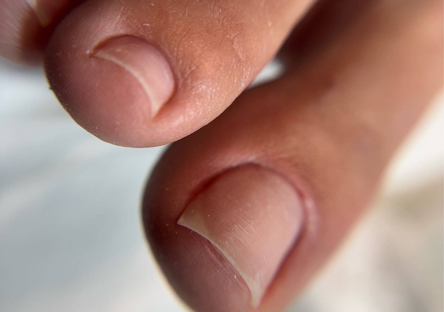 Regular Pedicure /No Hongos - Not fungus