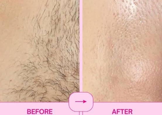 Brazilian Maintenance 