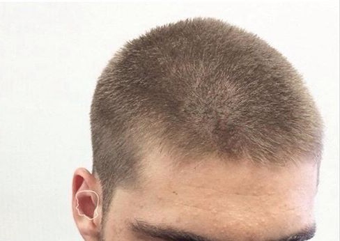 Haar Skeer (Een Lengte)