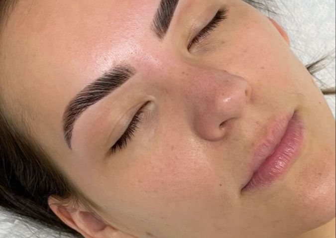 (Brows) - Brow Rehabilitation