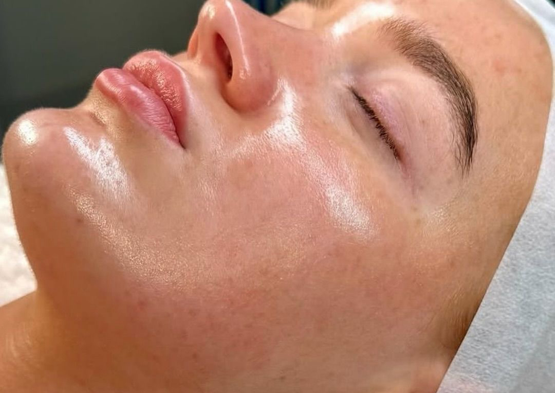 Customized Corrective Peel 