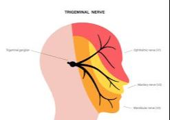 Botox for Trigeminal Neuralgia