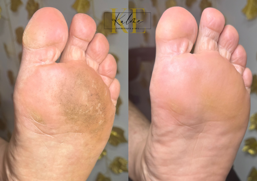 Pedicura Spa Con Esmaltado En Gel