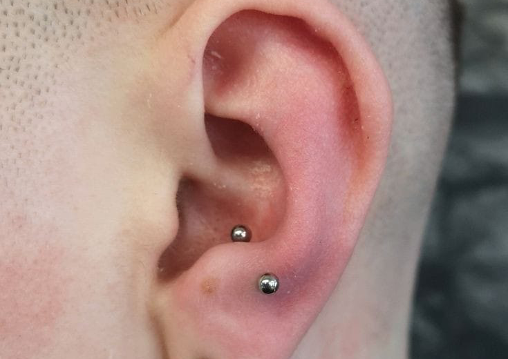 Anti tragus 