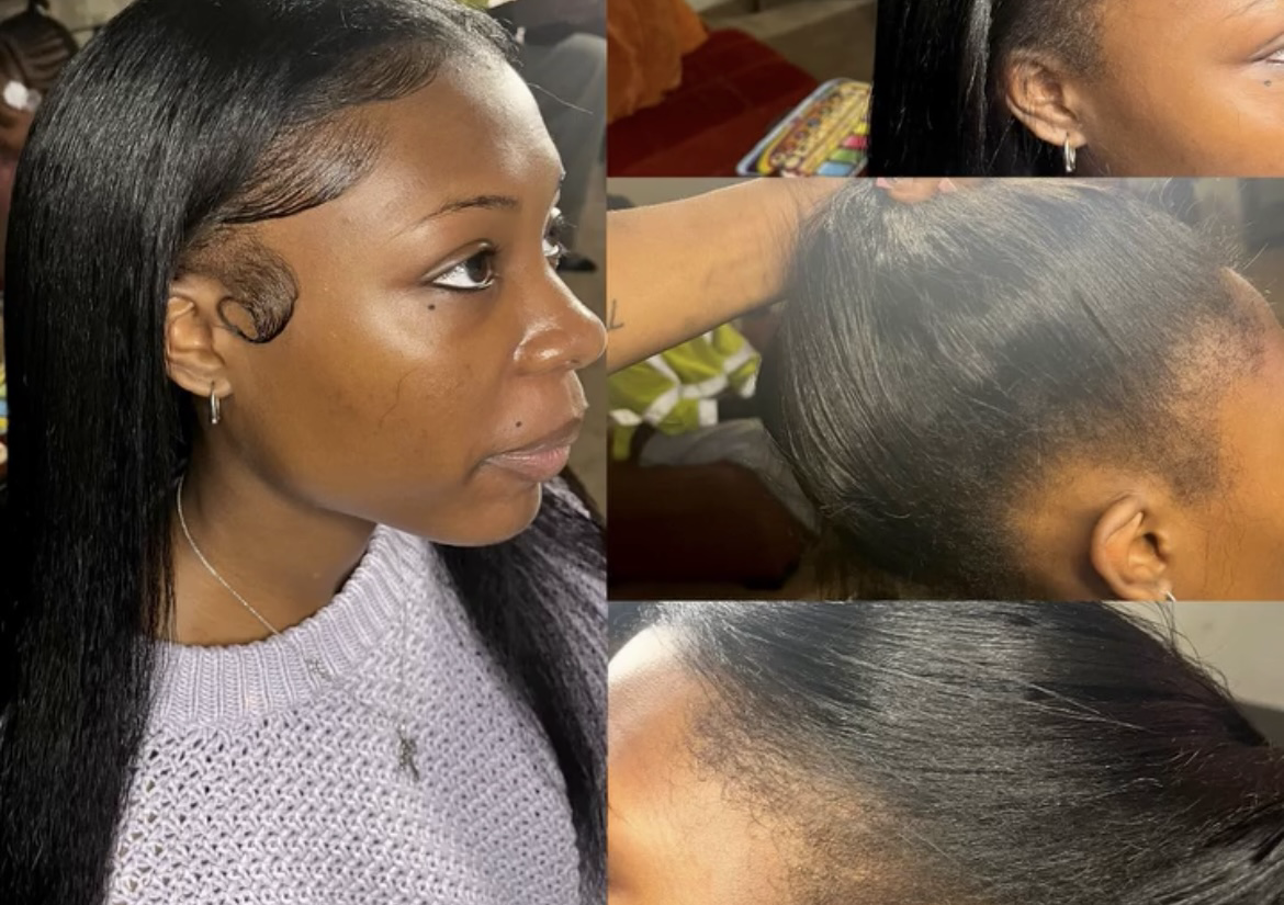 Traditional/Versatile sew in