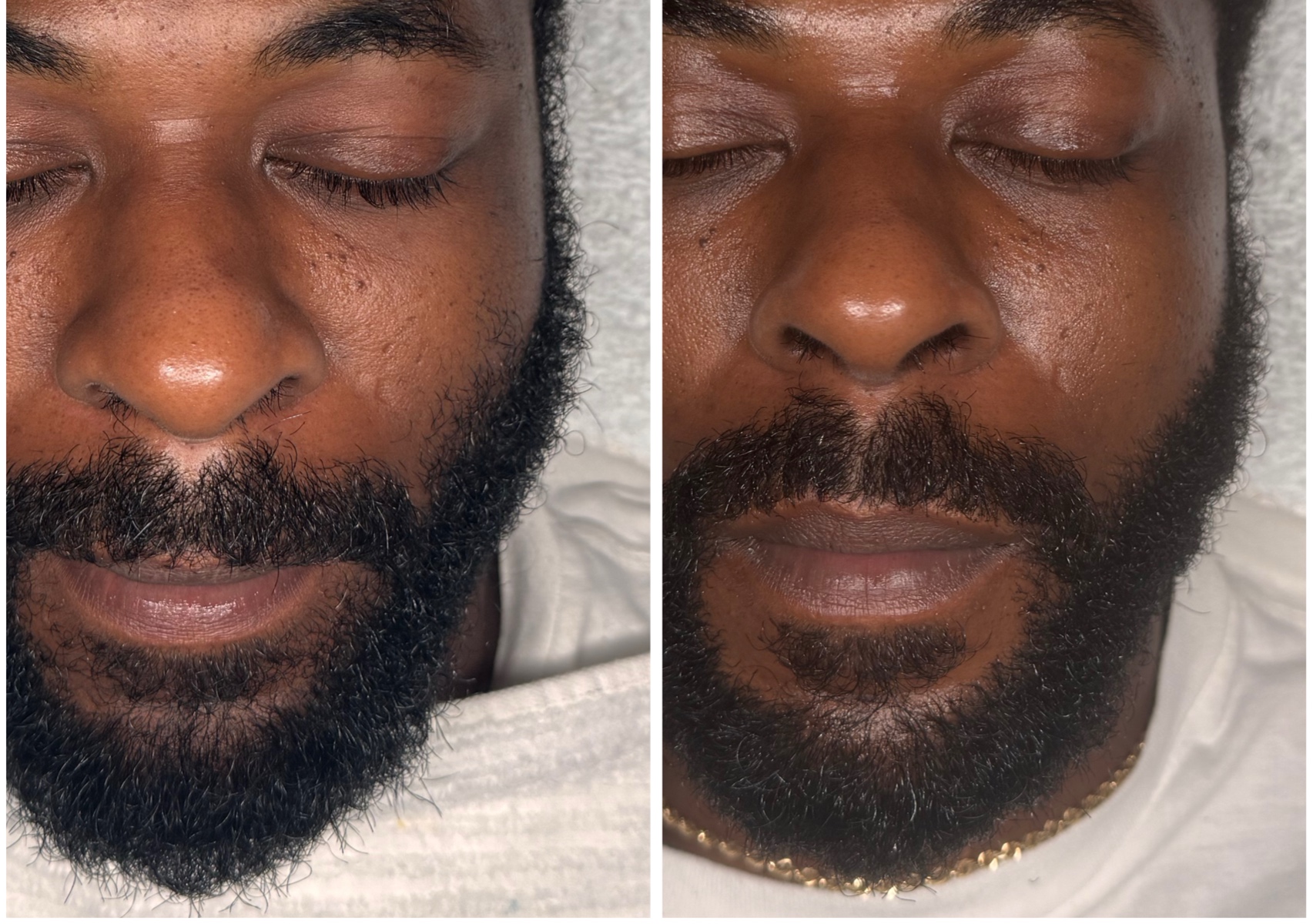 Beard Detox Facial