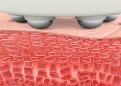 Beadatinė mezoterapija+miostimuliacija