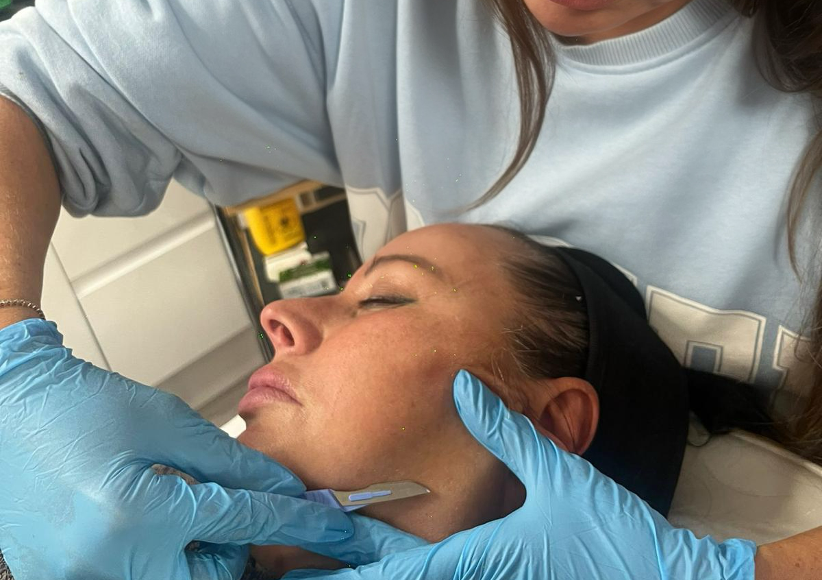 Dermaplan Facial
