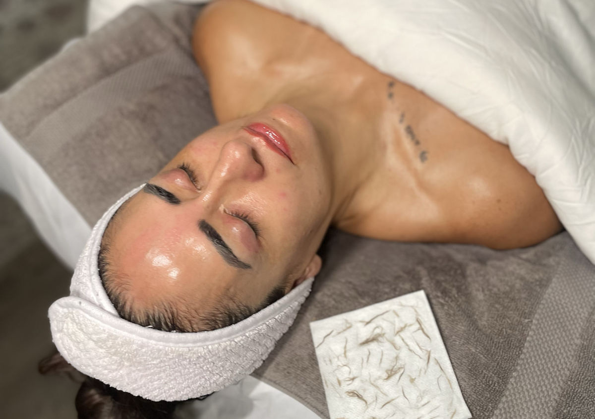 Dermaplane PDRN+ Peel