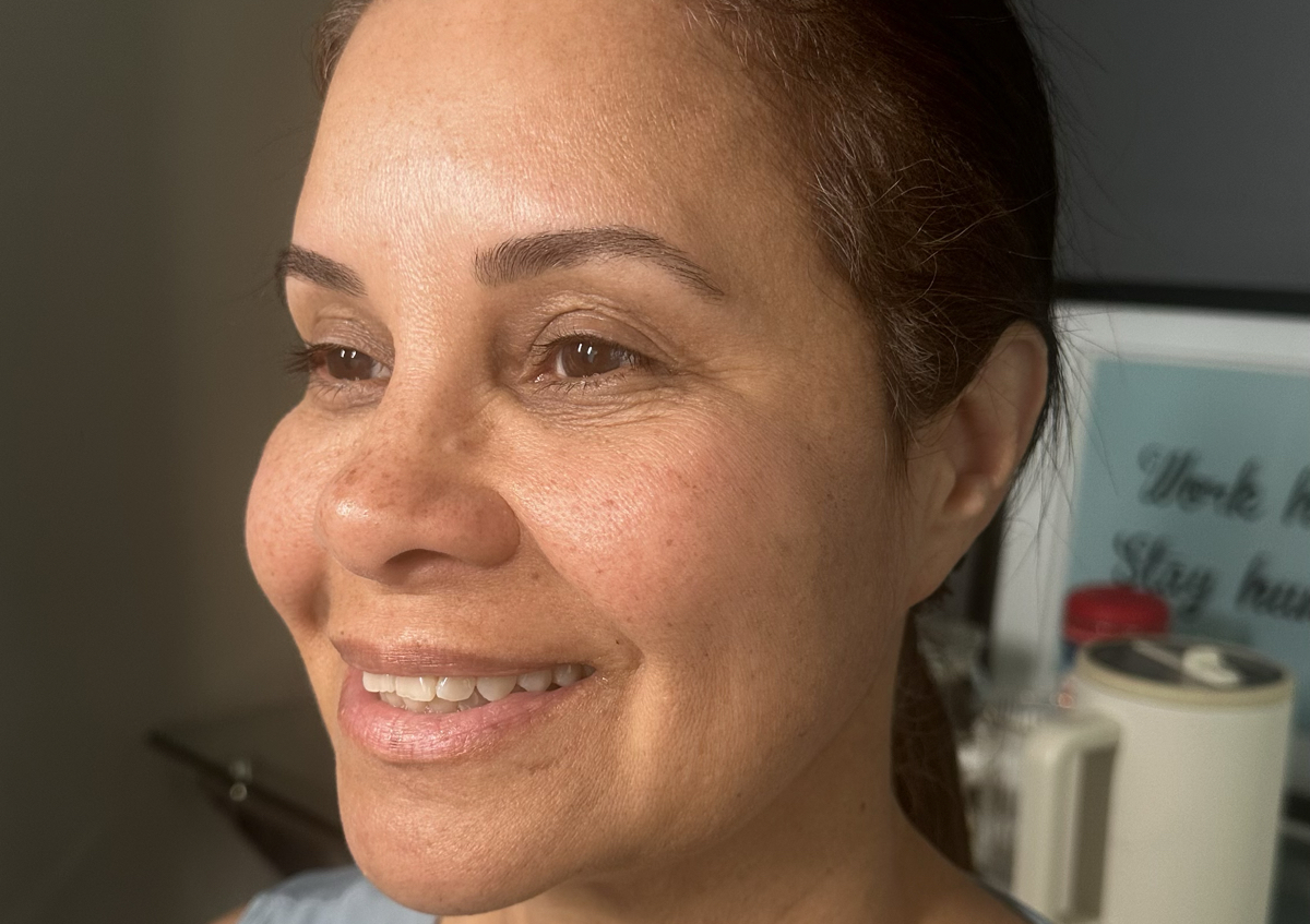 Package SILVER - Microneedling(3- sessions) + VIT C + COLLAGEN(3- sessions)