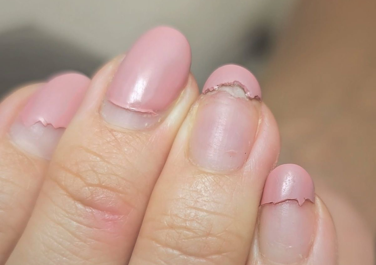 ++Broken Nail Fix (per nail)