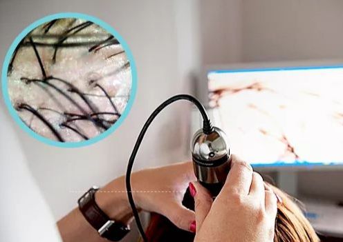 Diagnóstico capilar