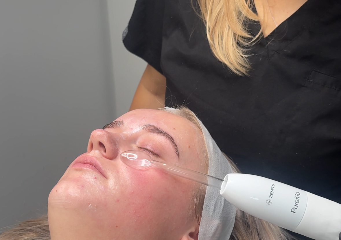 High Frequency Facial ⚡️