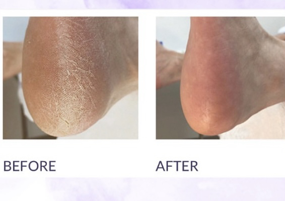 Delux dry pedicure treatment 