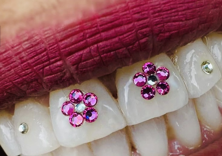 Double Flower & 2 Diamonds