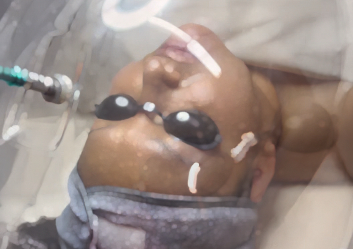 Luxury Hydrodermabrasion w/Oxivelour Dome 